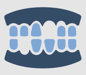 Illustration of a smile with a missing tooth, highlighting the need to replace a missing tooth with dental implants.
