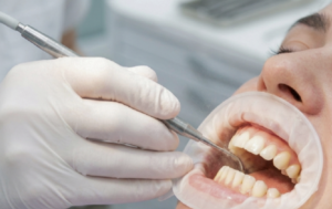 Dentist performing a periodontal cleaning to remove plaque and tartar below the gumline at Progressive Dental Care in Portland, ME.