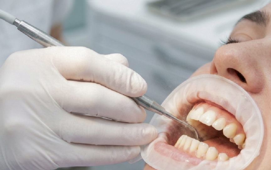 Dentist performing a periodontal cleaning to remove plaque and tartar below the gumline at Progressive Dental Care in Portland, ME.