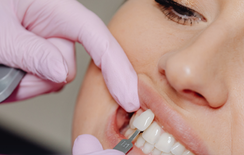 Cosmetic dentist matching a tooth shade for a patient at Progressive Dental Care in Portland, ME.